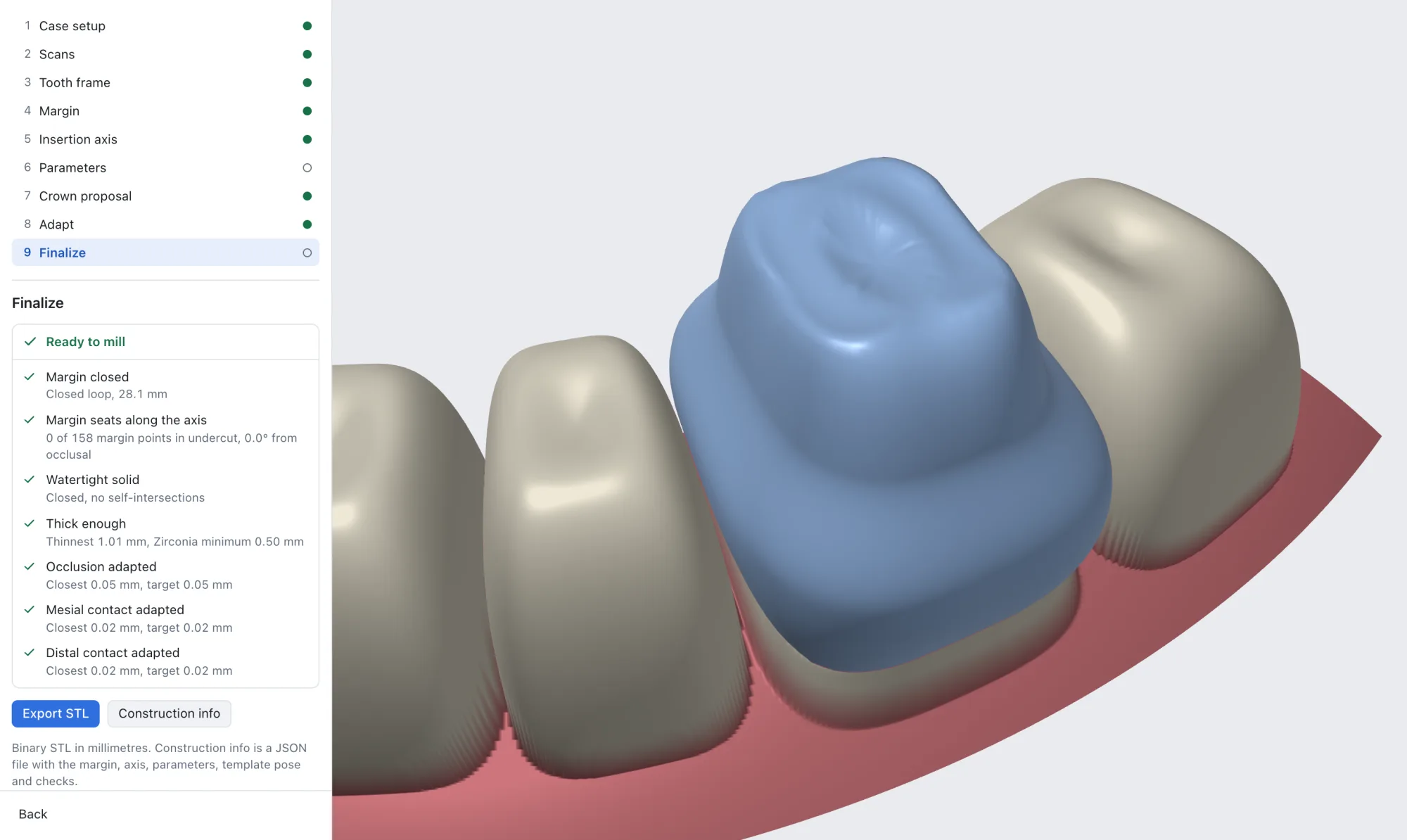 The editor at the Finalize step: the nine-step rail, a Ready to mill list (margin closed at 28.1 mm, 0 of 158 margin points in undercut, watertight, thinnest 1.01 mm against a 0.50 mm minimum, occlusion and contacts adapted) and the crown between its neighbours.