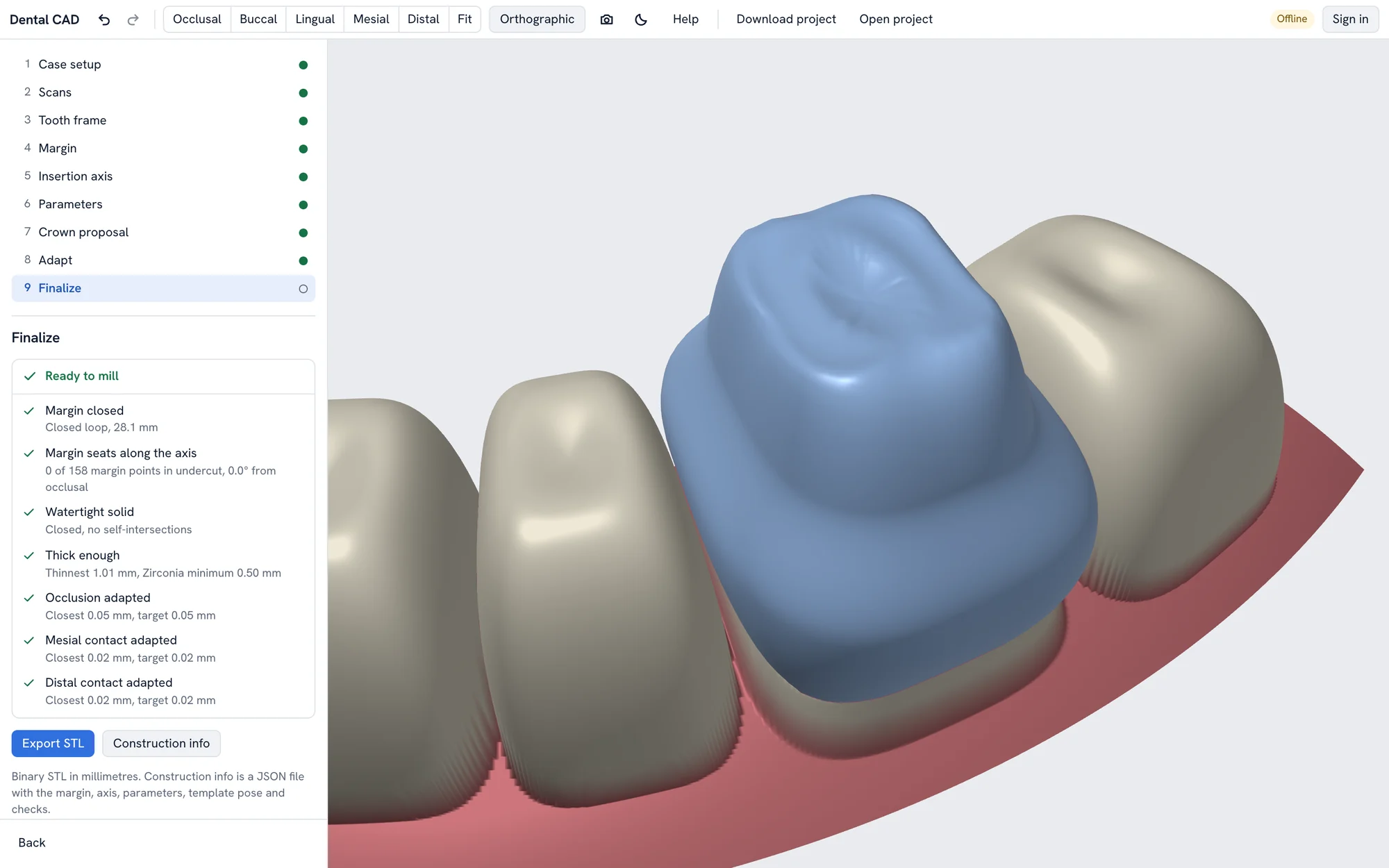 The editor at the Finalize step: the nine-step rail, a Ready to mill list (margin closed at 28.1 mm, 0 of 158 margin points in undercut, watertight, thinnest 1.01 mm against a 0.50 mm minimum, occlusion and contacts adapted) and the crown between its neighbours.
